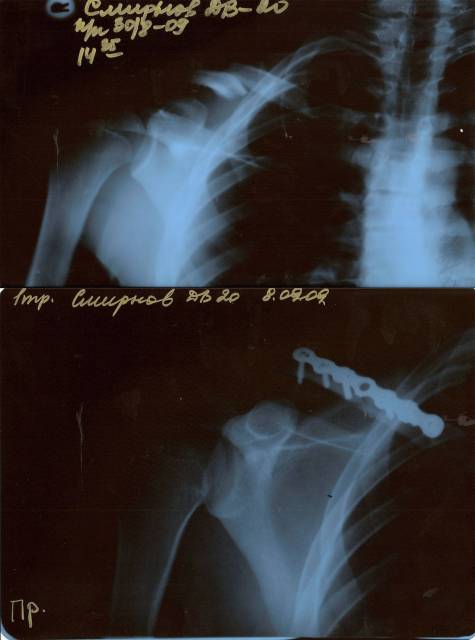 �������, ����� ���������� � ������ ������