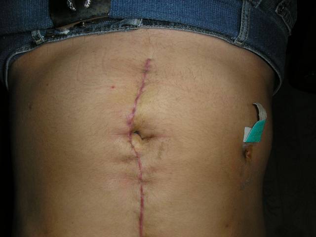 �������, ����� ���������� � ������ ������