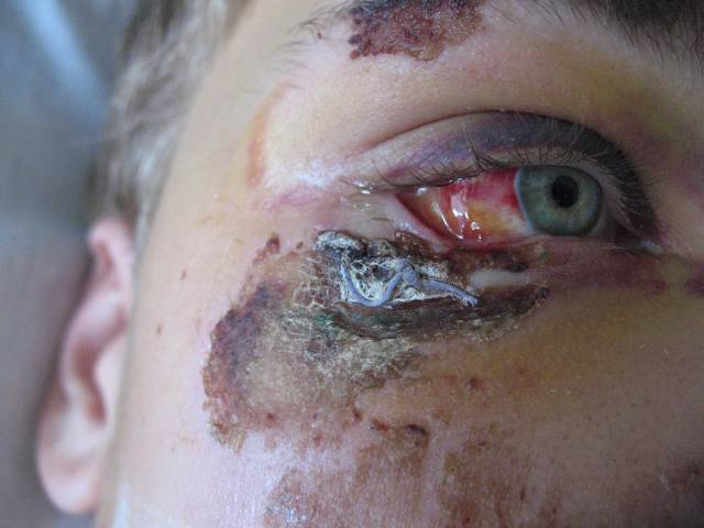 �������, ����� ���������� � ������ ������