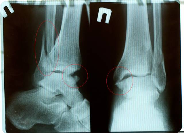 �������, ����� ���������� � ������ ������