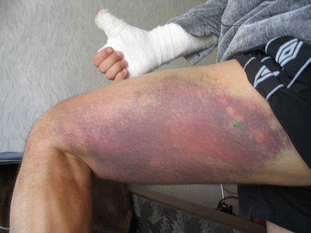 �������, ����� ���������� � ������ ������