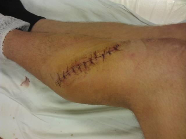 �������, ����� ���������� � ������ ������