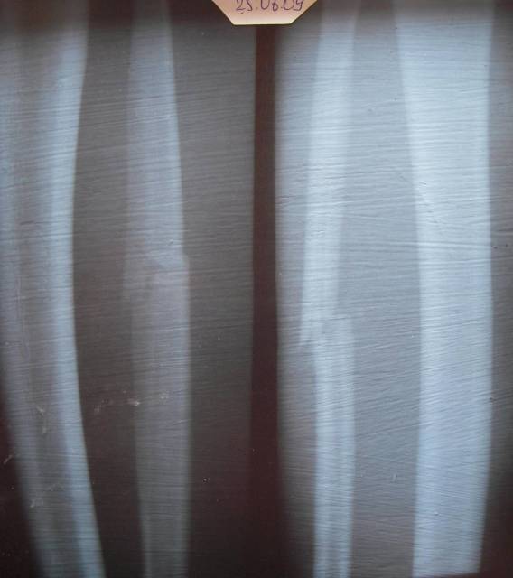 �������, ����� ���������� � ������ ������