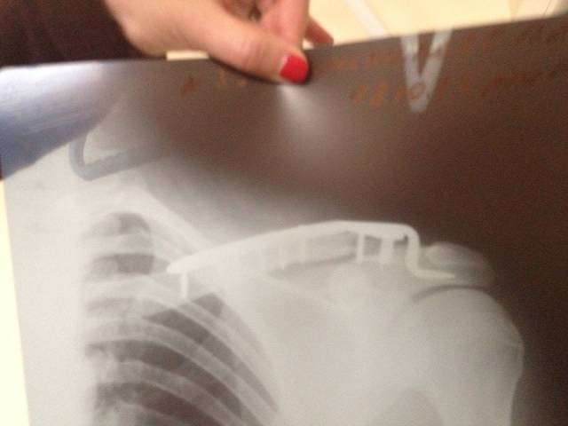 �������, ����� ���������� � ������ ������