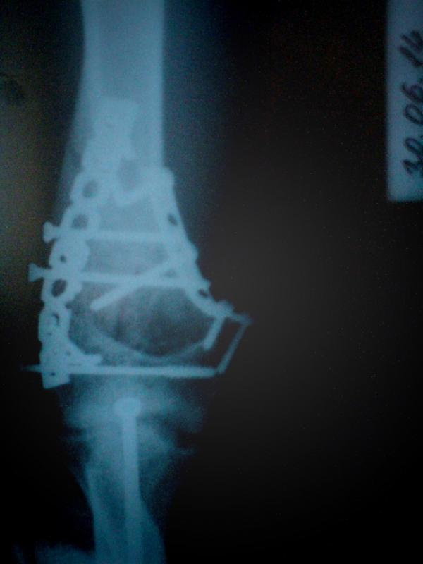 �������, ����� ���������� � ������ ������